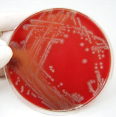 Petry Dish with Mold Bacteria Virus Super Bugs Los Angeles Health and Safety